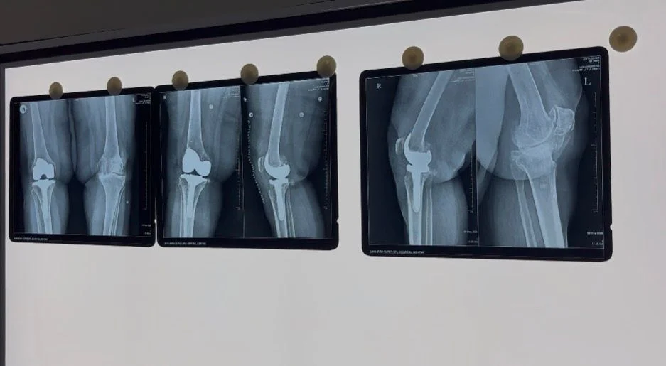 X-Ray
